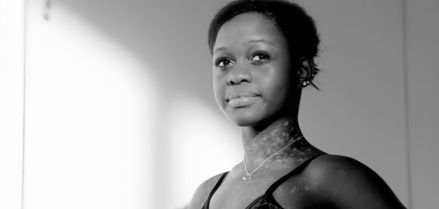 Michaela Deprince: Una huérfana de la guerra de Sierra Leona que convierte en bailarina de ballet
